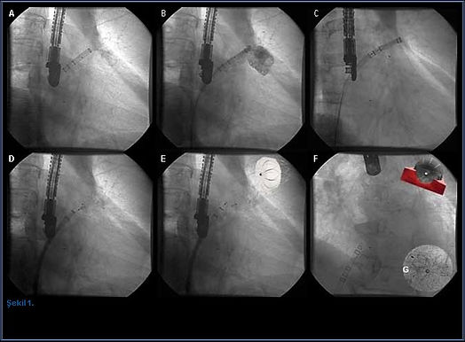 09eb85 ffbc1519006b40daa3f0342d6e5de145~mv2